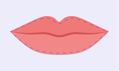 Bow-shaped lips